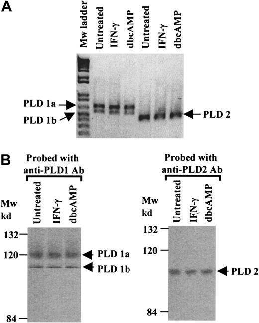Fig. 1. PLD expression profiles in U937 cells. / (A) RT-PCR was performed with mRNA extracted from untreated, IFN-γ–primed and dbcAMP-differentiated U937 cells. Specific primers for PLD1 (which yield 2 fragments corresponding to PLD1a, 640bp, and PLD1b, 520bp) and primers specific for PLD2 amplifying a 450-bp fragment, were used. The results shown are typical from 3 separate experiments. (B) Western blot analysis of immunoprecipitates of PLD1 or PLD2, from cell lysates from untreated, IFN-γ–primed and dbcAMP-differentiated U937 cells, were resolved by SDS/PAGE 8% polyacrylamide gels. Proteins were transferred to nitrocellulose and probed with anti-PLD1 or anti-PLD2 antibodies. The results shown are typical from 3 separate experiments. Mw indicates molecular weight.