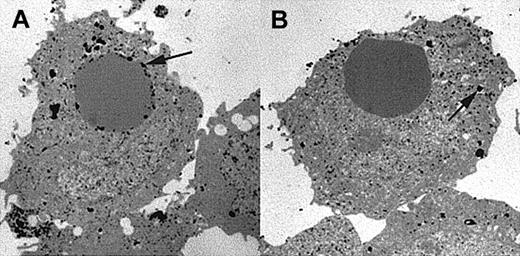 Fig. 4. Electron micrographs showing location of acid phosphatase, a lysosomal enzyme. / Micrographs are representative examples of experiments repeated 4 times. Transfectant CHO cells were allowed to internalize IgG-coated EAs and then fixed and stained for acid phosphatase. (A) Internalization via wild-type FcγRIIA (clone 131-3) exhibits strong acid phosphatase activity near the internalized target in 61 of 63 internal targets counted (n = 4 for both lines). (B) However, internalization via tail-minus FcγRIIA (clone 169-23), using CR3 to mediate the phagocytic signal, does not show colocalization of the target with acid phosphatase activity (arrows). When counted, only 9 of 97 internal targets show colocalization with acid phasphatase (original magnification × 6000).
