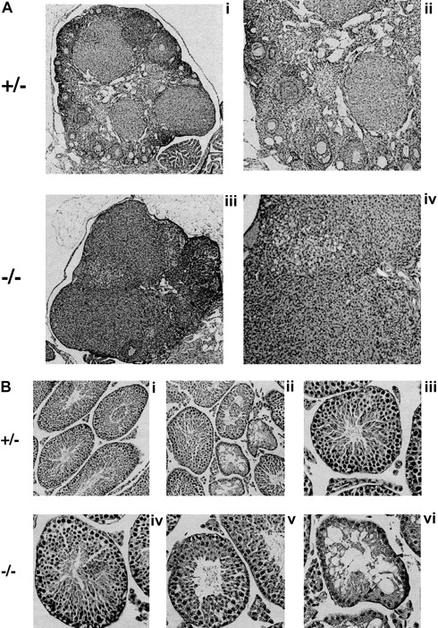 Fig. 6. Fancg −/− mice have germ cell defects and decreased fertility. / (A) Histology of mutant and control ovaries (hematoxylin and eosin staining). Ovary of an 8-week-old mutant or control mouse. The mutant ovary was almost completely devoid of follicles (iii, × 60; iv, × 125). The control ovary had an abundance of developing follicles at various stages (i, × 60; ii, × 125). (B) Histology of mutant and control testis (hematoxylin and eosin staining). A mosaic pattern of seminiferous tubules devoid of germ cells and normal tubules can be seen in the mutant testis (iv, × 250; v and vi, × 320). A control testis is shown at the same magnification (i, ii, iii). Arrows indicate Sertoli cells.