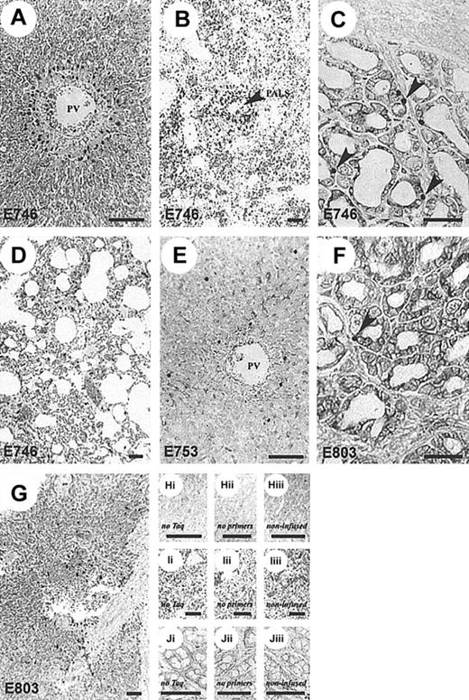 Fig. 4. GFP+-,. / neo+-transduced CTLs infiltrate target tissues. Representative histologic sections showing patterns of CTL localization in dogs receiving neo-transduced, donor-derived, recipient-specific CTLs and DLA-haploidentical marrow (A-D) compared to autologous CTLs and marrow (E-G).Neo+ CTLs localized to sites common to GVHD but only in dogs receiving allogeneic marrow. Aggregates ofneo+ cells were present in areas adjacent to the portal tracts identified by the hepatic portal vein (PV) (A) and splenic periarteriolar lymphatic sheaths (PALS, arrow) (B). Increased numbers of neo+ cells were also present within the lamina propria of the colon (arrows) (C) and scattered throughout the pulmonary interstitium (D). Autologous CTL infusions (E-G) resulted in random distribution of gene-marked T cells in liver (E), colon (F) (arrow indicates examples of neo+cells), and spleen (G). A full description of ISH-PCR assay and tissue controls (H-J), as described in “Materials and methods” and elsewhere,2627 was used to validate these findings. Bar, 100 μm; original magnification × 100 (A, C, E, F, H, J) and × 40 (B, D, G, I).