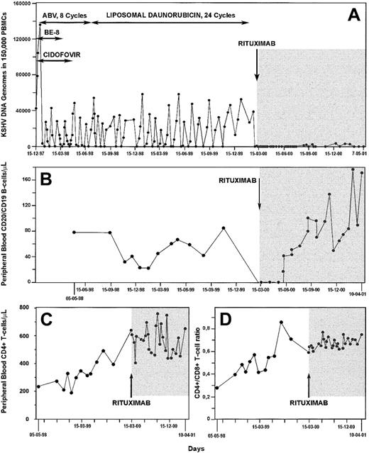 Fig. 2. Kinetics of circulating KSHV DNA burden and lymphocyte subsets during a 3-year follow-up period in the patient with multicentric Castleman disease. / Changes in KSHV DNA load in PBMCs (A), peripheral blood CD19/CD20+ B cell counts (B), CD4+ T-cell counts (C), and CD4+/CD8+ T-cell ratio (D) in an HIV-1– infected patient with multicentric Castleman disease during treatment with cidofovir, antihuman IL-6 monoclonal antibody (BE-8), and cytotoxic therapy (horizontal arrows) and after a single dose of anti-CD20 monoclonal antibody (shaded area). Throughout most of the study period, the patient was under effective, highly active antiretroviral therapy.