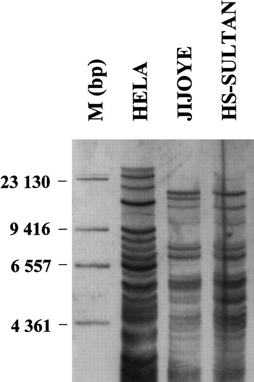 Fig. 1. High-resolution DNA fingerprint analysis of cell lines Jijoye and HS-Sultan. / A multiple-locus DNA profile of the indicated cell lines was generated using 10 μg of DNA digested to completion (HinfI), size-separated on agarose gels and blotted on positively-charged nylon membranes. After hybridization with a digoxigenin-labelled (GTG)5 oligonucleotide as probe, a chemoluminescent detection of (GTG)5 was carried out and the blot exposed for 15 minutes to X-ray films. Molecular weight markers were used for size determination. Cervix carcinoma cell line HELA was used as positive control. The methods used have been described in details elsewhere.1113