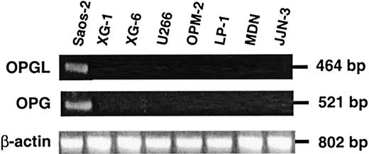 Fig. 1. HMCLs express neither OPGL nor OPG mRNA. / Analysis of the expression of OPGL, OPG, and β-actin mRNA by RT-PCR in HMCLs. The osteosarcoma cell line Saos-2 was used as positive control.