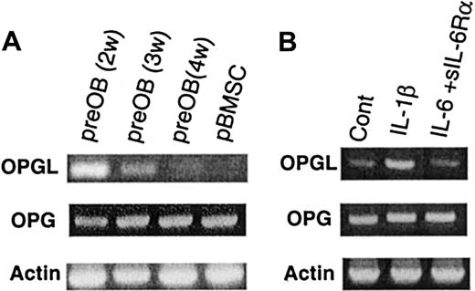 Fig. 2. OPG and OPGL mRNAs are expressed in the BM environment and are regulated by IL-1β. / (A) OPGL, OPG, and β-actin mRNA were analyzed by semiquantitative RT-PCR in BMSCs and in preOBs at 2 to 4 weeks of culture. (B) Effect of IL-1β (10 ng/mL) or IL-6 (100 ng/mL) plus sIL-6Rα (250 ng/mL) on OPGL and OPG mRNA expression by preOBs. The figures are representative of 3 independent RT-PCR reactions. Cont indicates control.