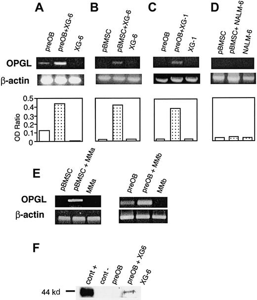 Fig. 3. HMCLs up-regulate OPGL expression in coculture. / Semiquantitative RT-PCR analysis of OPGL and β-actin mRNA in the following coculture systems: XG-6 with preOBs (A) or with BMSCs (B), XG-1 with preOBs (C), pre–B-cell line NALM-6 with BMSCs (D), and primary myeloma cells isolated from 2 patients with BMSCs or preOBs (E). Graphics represent the mean optical density (OD) of OPGL normalized to the OD of β-actin ( = OD ratio) of representative experiments. (F) Immunoblot analysis of OPGL in the following cellular lysates: COS-7 transfected with OPGL-pCEP4 = cont+ (lane 1), COS-7 transfected with empty pCEP4 = cont− (lane 2), preOBs (lane 3), preOBs and XG-6 after 36 hours of coculture (lane 4), and XG-6 (lane 5).