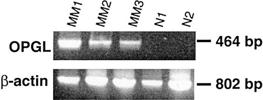 Fig. 7. Ex vivo BM specimens obtained from patients with MM overexpress OPGL mRNA in comparison with those from healthy donors. / All BM mononuclear cells were cultured for 2 weeks, and the expression of mRNA was assessed in adherent cells by semiquantitative RT-PCR analysis in BM samples obtained from MM patients with osteolytic lesions (MM1, MM2, MM3) in comparison with BM samples from healthy donors (N1 and N2).