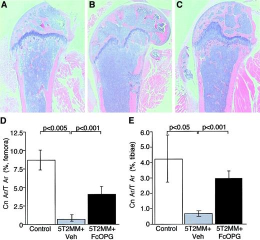 Fig. 4. The effect of OPG on cancellous bone area in mice bearing 5T2MM myeloma cells. / (A) Section of the femur from a control, uninjected animal. (B) Section of the femur from an animal injected with 5T2MM cells and vehicle, showing the decrease in cancellous bone area. (C) Section of the femur from an animal injected with 5T2MM cells and treated with OPG. (D) Cancellous bone area as a percentage of total area in the femora of control animals, animals injected with 5T2MM cells and vehicle, and animals injected with 5T2MM cells and OPG. (E) Cancellous bone area as a percentage of total area in the tibiae of control animals, animals injected with 5T2MM cells and vehicle, and animals injected with 5T2MM cells and OPG. Original magnification × 1.6.