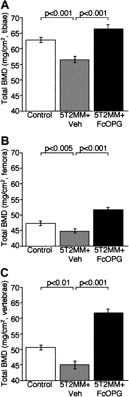 Fig. 6. The effect of OPG on total BMD, assessed by dual-energy x-ray absorptiometry, in mice bearing 5T2MM myeloma cells. / (A) Total BMD in the tibiae of control animals, animals injected with 5T2MM cells and vehicle, and animals injected with 5T2MM cells and OPG. (B) Total BMD in the femora of control animals, animals injected with 5T2MM cells and vehicle, and animals injected with 5T2MM cells and treated with OPG. (C) Total BMD in the lumbar vertebrae of control animals, animals injected with 5T2MM cells and vehicle, and animals injected with 5T2MM cells and OPG.