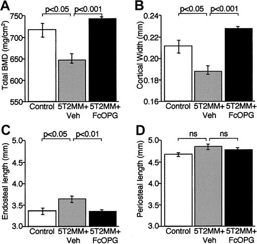 Fig. 7. The effect of OPG treatment on total BMD and morphometric indices of cortical structure in the femora of 5T2MM-bearing mice. / BMD and cortical morphometry were assessed by pQCT in control mice, animals injected with 5T2MM cells and vehicle, and animals injected with 5T2MM cells and treated with OPG. (A) Total BMD. (B) Cortical width. (C) Endosteal length. (D) Periosteal length.