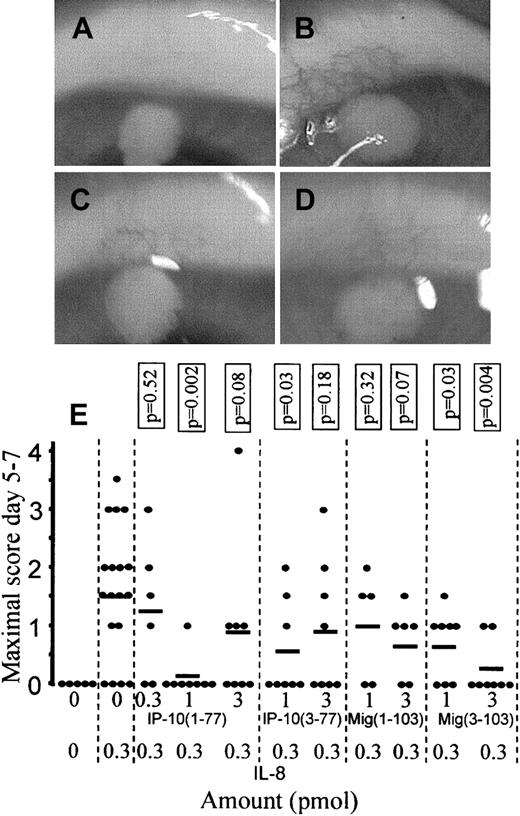 Fig. 8. Comparison of the antiangiogenic activity of intact and CD26/DPP IV–truncated CXCR3 ligands. / Hydron pellets were implanted in a corneal micropocket on a rabbit eye. Hydron pellets contained dilution buffer (A), 0.3 pmol natural human IL-8 (B), 0.3 pmol natural human IL-8 and 1 pmol intact IP-10(1-77) (C), or 0.3 pmol natural human IL-8 and 1 pmol of IP-10(3-77) (D). Neovascularization was scored daily (score 0-4) from days 4 to 8 and the maximal neovascularization (occurring between days 5 and 7) obtained with IL-8 with or without intact or CD26/DPP IV–truncated IP-10 or Mig is shown in panel E (each dot represents an independent experiment). The mean values are indicated by the lines and statistical analysis (comparison with the positive control that contained 0.3 pmol IL-8) was performed using the Mann-Whitney U test. The photographs in panels A to D are representative examples for the mean neovascularization scores obtained with IL-8 and IP-10 as indicated in panel E.