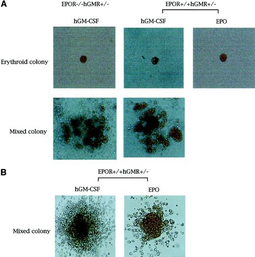 Fig. 1. Appearance of erythroid and erythrocyte-containing mixed hematopoietic colonies. / Erythroid and erythrocyte-containing mixed hematopoietic colonies (original magnification, × 400 and × 100, respectively. (A) From E12.5 FL cells of EPOR−/−hGMR+/−embryos induced by hGM-CSF, and EPOR+/+hGMR+/−embryos induced by hGM-CSF or EPO. (B) From E8.0 YS cells of EPOR+/+hGMR+/− embryo induced by hGM-CSF or EPO.