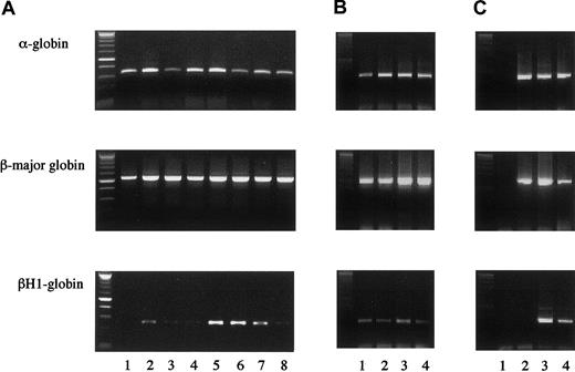 Fig. 3. Globin gene expression in single erythrocyte-containing colonies. / (A) Colonies formed by hGM-CSF from E12.5 FL cells of hGMR-expressing EPOR+/+ embryos (lanes 1 to 4) and EPOR−/−embryos (lanes 5 to 8). (B) Colonies formed by hGM-CSF from E8.0 YS cells of hGMR-expressing EPOR+/+ embryos. (C) Globin gene expression of a granulocyte-macrophage colony formed by hGM-CSF from E12.5 FL cells of hGMR-expressing EPOR+/+ embryos as a negative control (lane 1), adult bone marrow cells (lane 2), E12.5 FL cells (lane 3), and E9.5 YS cells of hGMR-expressing mice (lane 4).