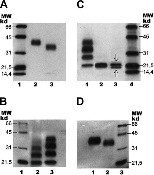 Fig. 4. SDS-PAGE with subsequent immunoblotting of human serum EPO. / Separation of human serum EPO and rhEPO by SDS-PAGE followed by immunoblotting. Samples were stained with a biotinylated monoclonal antibody against hEPO using horseradish peroxidase–labeled streptavidin and a chemiluminescent substrate. (A) Lane 1: molecular weight (MW) markers. Lane 2: epoetin alfa (1 ng). Lane 3: human serum EPO (1 ng). (B) Lane 1: molecular weight markers. Lane 2: human serum EPO (1 ng) after incomplete digestion with PNGase F. Lane 3: epoetin alfa (5 ng) after incomplete digestion with PNGase F. (C) Lane 1: epoetin alfa (5 ng) after incomplete digestion with PNGase F. Lane 2: epoetin alfa (5 ng) after complete digestion with PNGase F. Lane 3: human serum EPO (2 ng) after complete digestion with PNGase F (⇓O-glycosylated EPO; ⇑ non–O-glycosylated EPO). Lane 4: molecular weight markers. (D) Lane 1: fully glycosylated epoetin alfa (5 ng). Lane 2: epoetin alfa (10 ng) after treatment withArthrobacter ureafaciens sialidase. Lane 3: molecular weight markers.