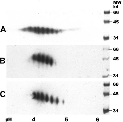 Fig. 5. Two-dimensional gel electrophoresis of human serum EPO. / IEF was carried out by using IPG strips with a pH gradient of 3 to 6. SDS-PAGE was performed in 12% gels followed by immunoblotting. Samples were detected with a biotinylated monoclonal antibody against hEPO using horseradish peroxidase–labeled streptavidin and a chemiluminescent substrate. (A) Human serum EPO (65 ng). (B) Epoetin alfa (50 ng). (C) Epoetin beta (50 ng).