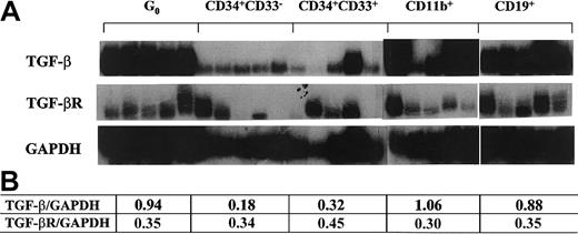 Fig. 3. TGF-β1 and TβR II expression in different subsets of single human hematopoietic cells. / Flow cytometry–sorted cells were individually isolated by micromanipulator and analyzed using poly-dT–primed RT-PCR probed with radiolabeled gene-specific cDNA. Panels of 5 cells of each type were used. Quantitative analysis of the tested genes normalized to GAPDH signals with densitometry software (NIHimager) are presented in the table.