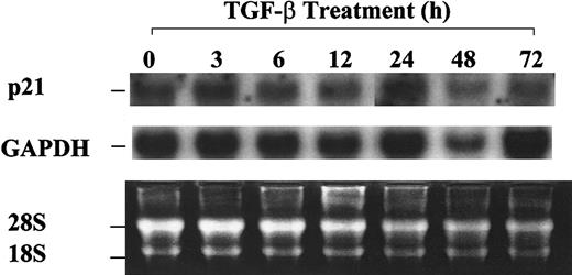 Fig. 5. Absence of p21 up-regulation by TGF-β1 in asynchronized 32D cells. / 32D cells were treated with 20 ng/mL TGF-β1 and were collected at the indicated time points. Total RNA was isolated, and Northern blot analysis was performed as described in “Materials and methods.”