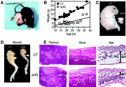 Fig. 2. cux/CDPΔHD/ΔHD mice have pleiotropic abnormalities. / (A) Comparison of 14-day-old male littermates heterozygous (right) and homozygous (left) for the cux/CDPΔHD allele. (B) Comparative graph of the relationship between age and weights of wild-type/heterozygous (CT) and homozygous (ΔHD) littermates aged between 10 and 37 days. Comparison of thymus (C) and (D) hind leg sizes fromcux/CDPΔHD/ΔHD and control littermates. Arrow indicates reduced size of calf muscle. (E) Histologic comparisons of cux/CDPΔHD/ΔHD(ΔHD) andcux/CDP+/ΔHD (CT) thymus, femur (arrowheads show bone fragmentation), and skin (bars show thickness of subcutaneous fat); c indicates cortex; m, medulla; bm, bone marrow; scf, subcutaneous fat. Magnification 100 ×.