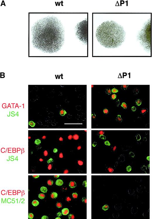 Fig. 5. v-Myb LZR regulates commitment of common myeloid progenitors. / (A) Colonies of wild-type and ΔP1 v-Myb cells grown in the presence of TGFα, bFGF, and SCF in semisolid medium. (B) Indirect immunofluorescence analysis of representative wild-type and ΔP1 v-Myb cell clones after expansion and differentiation induction by growth factors removal. Double-staining for nuclear antigens (GATA-1 or C/EBPβ, red) and surface antigens (JS4 or MC51/2, green). The bar represents 15 μm.