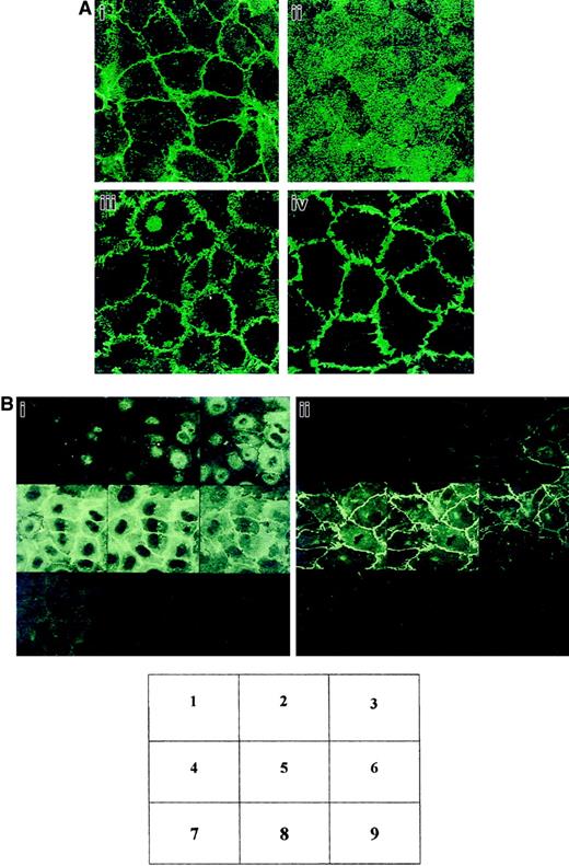 Fig. 1. CD146 localization at the cell-cell contacts on cultured ECs examined by confocal microscopy. / (A) HUVECs were grown to confluence on coverslips. The cells were stained with anti-CD146 (i), anti–MHC class I used as a control (ii), anti–VE-cadherin (iii), or anti–PECAM-1 (iv). Magnification × 100. (B) Optical sections of endothelial monolayer were obtained with confocal microscopy from the apical (1-3), intermediate (4-6), and basal (7-9) sides of the cells. (i) Labeling for CD146. (ii) VE-cadherin. Magnification × 100.