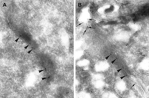 Fig. 3. Immunogold labeling of endothelial junction for CD146 and VE-cadherin. / (A) Immunogold labeling of endothelial junction for VE-cadherin, a specific marker of AJs. Gold particles appear at the electron-dense zone of the interendothelial junction, which is thus identified as an AJ (arrowheads; magnification × 71 000). (B) Double immunolabeling for CD146 (5 nm gold) and VE-cadherin (10 nm gold). CD146 is detected apart from the AJ (arrows) and identified as such by the presence of VE-cadherin (magnification × 71 000).