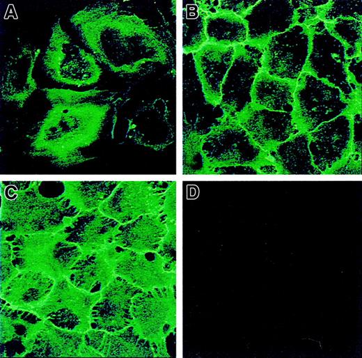 Fig. 4. CD146 localization on HUVECs at different stages of confluence by confocal microscopy. / In subconfluent HUVECs (A), CD146 was initially perinuclear with some peripheral patches. With the progression of intercellular contacts, an increase in CD146 was observed—as a fine line along the cell periphery at the beginning of confluence (B, recently confluent) and as a thicker line after prolonged confluence, with intercellular digitations (C). At late confluence (D), the cells were also stained with ST4, an irrelevant mAb used as a control. Magnification × 100.