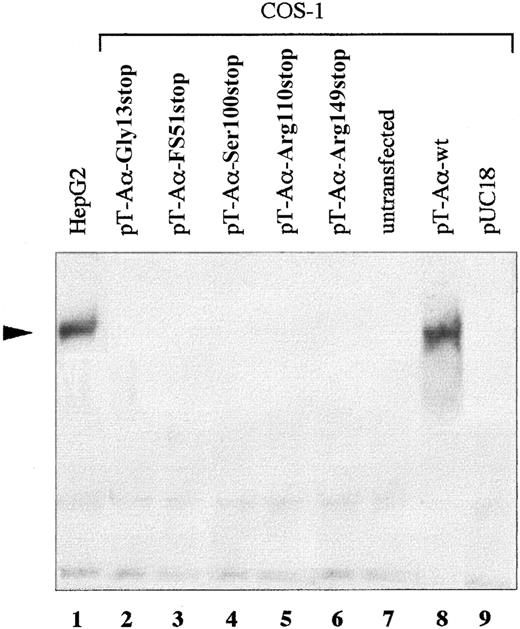 Fig. 4. Expression of wild-type and mutant fibrinogens. / Fibrinogens secreted from COS-1 cells, transfected with wild-type Bβ- and γ-chains, together with each mutant (Gly13stop, FS51stop, Ser100stop, Arg110stop, and Arg149stop) Aα-chain were analyzed as shown. Transfections, untransfected HepG2 controls, SDS-PAGE, and Western blot were carried out as described in “Materials and methods.” Proteins were separated on 4% SDS-PAGE under nonreducing conditions. The arrowhead indicates the 340-kd normal fibrinogen.