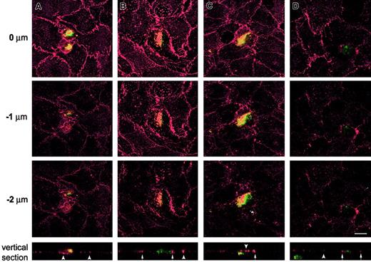 Fig. 3. Confocal microscopy analysis of the localization of CD9 and CD81 tetraspanins during active TEM in 3-dimensional collagen gels. / BCECF-labeled A375 cells were added to confluent ECs grown onto dehydrated collagen gels and allowed to migrate for 2 to 6 hours. After fixation the cocultures were stained in red fluorescence for CD9 (A-C) and for CD81 (D). Each series of panels (A-D) depicts horizontal (xy) confocal sections distanced 1 μm on the z-axis. Z = 0 corresponds to the level of EC-EC junction. A representative vertical (xz) section is shown at the bottom of each corresponding series. Note that green shows the position of melanoma cells but did not completely stain the periphery of spread tumor cells. In the vertical sections, TC-EC heterotypic junctions are indicated by arrows, and EC-EC homotypic junctions are indicated by arrowheads. Bar, 10 μm.