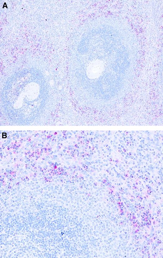 Fig. 1. Localization of PrPC-expressing cells in tissue from human spleen. / The bulk of strongly PrPC-expressing cells (clone 3F4, red) are found in the red pulp (RP) immediately adjacent to the white pulp (WP). Tissue sections were counterstained with hematoxylin.