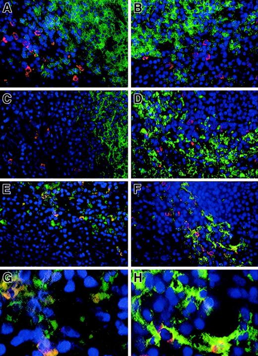 Fig. 2. The human spleen cells that strongly express PrPC have an immunophenotype consistent with myeloid DCs. / (A-H) Identification of PrPC-expressing cells by dual-color immunolocalization. PrPC was identified using rabbit antiserum R26 and detected using Texas red-labeled antirabbit immunoglobulin (red) in all cases. Lineage-restricted mouse monoclonal antibodies (as indicated) to normal splenic cell types were detected using FITC-labeled antimouse immunoglobulin (green). Cell nuclei were identified by DAPI (blue). Sensitivity of the detection system was adjusted to identify only the strongly expressing cells. Strong PrPC-expressing cells are rarely found in the T-cell area (panel A, CD3) or B-cell area (panel B, CD20); the antigen is not strongly expressed on FDCs (panel C, CR4/23). Cells strongly expressing PrPC are clearly separate from surrounding monocytes/macrophages (panel D, CD68). Unstained cells (top right) represent an adjacent lymphoid area. Coexpression of PrPCwith CD13 (panel E and detail panel G) and CD11c (panel F and detail panel H) confirms myeloid origin and is indicated by an orange-yellow tone. Note that for CD11c (panel H) the cells coexpress PrPC and CD11c, but the intracellular localization is not identical. CD13+ or CD11c+, which do not express PrPC, are likely to represent monocyte-macrophage cells (panels E and F).