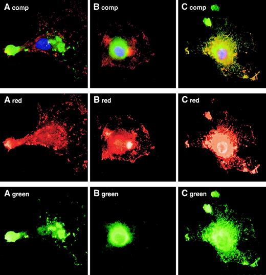 Fig. 4. PrPC colocalizes with the MHC class II compartment in monocyte-derived DCs. / Adherent immature monocyte-derived DCs were allowed to ingest FITC-dextran for 15 minutes to reveal endocytic vesicles (A), stained for talin to reveal adhesion plaques (B), or stained for MHC class II molecules to reveal the MHC class II compartment (C). PrPCis shown in red in each instance. Colocalization of green-red signal gives yellow fluorescence.