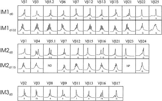 Fig. 1. TCR Vβ repertoire analysis of PBMCs from IM donors during acute infection and recovery. / Depicted are the Vβ values of the known 1 to 25 families with significant expansions. Significance was based on at least a 2-fold magnitude change and P < .05 against a control background (see “Materials and methods”). Profiles are displayed of fluorescence intensity (x-axis, arbitrary units) as a function of CDR3 size (y-axis, amino acids). CDR3 peaks are spaced 3 nucleotides apart. ND indicates not done; NP, not present.