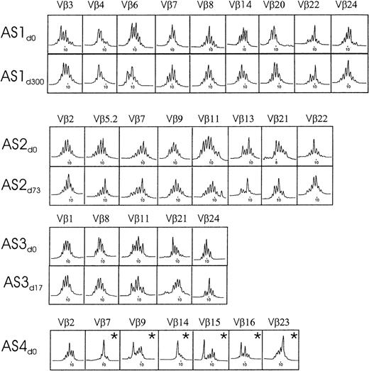 Fig. 3. TCR Vβ repertoire analysis of PBMCs from asymptomatic donors during acute and persistent infection. / Depicted are those Vβ values of the 1 to 25 known families who demonstrated a 2-fold magnitude change (see “Materials and methods”). Expansions that were statistically significant (P < .05) are indicated by an asterisk. Profiles are displayed of fluorescence intensity (x-axis, arbitrary units) as a function of CDR3 size (y-axis, amino acids). All CDR3 peaks are spaced 3 nucleotides apart.