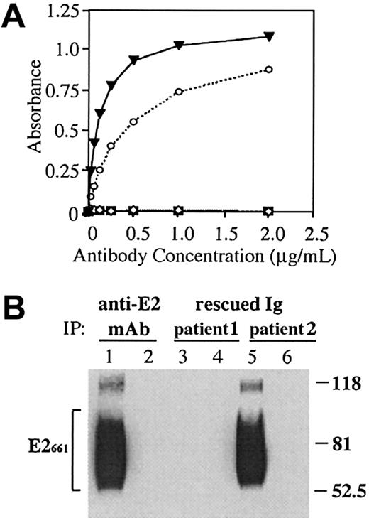 Fig. 1. A rescued immunoglobulin from an HCV-associated lymphoma binds soluble E2661. / (A) An anti-E2 mAb, CBH-4G (▾),27 HCV-associated immunoglobulin (patient 1, ⋄), HCV-associated immunoglobulin (patient 2, ○) and non-HCV lymphoma immunoglobulin controls (n = 23; ▪) were serially diluted and added to E2661-coated wells, and bound immunoglobulin was determined by ELISA. (B) Supernatants from AdV-infected HeLa cells expressing HCV-E2661 (lanes 1, 3, and 5) or LacZ (lanes 2, 4, and 6) were immunoprecipitated with immunoglobulins derived from an anti-E2 mAb (CBH-4G) and from the 2 HCV-associated lymphoma cases. Proteins were separated by SDS-PAGE, and blots were probed with an antibody against HCV-E2. Sizes (in kd) of protein markers are indicated on the right, and the bracket on the left indicates the precipitated heterogeneously glycosylated E2661 protein.
