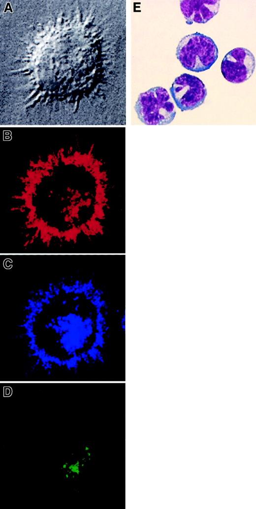 Fig. 3. Morphologic and confocal microscopy analysis of MDCs and PDCs isolated from AML patients. / CD11c+ MDCs were isolated from patient UPN71 and cultured in vitro for 3 days with GM-CSF, IL-4, and CD40L. (A) They display dendritic morphology as shown by interferential contrast transmission microscopy (×100). Three-color immunofluorescence staining was performed. (B) HLA-DR expression is shown in red, (C) CD83 in blue, and (D) DC-LAMP in green. (E) Giemsa staining of freshly isolated PDCs from patient UPN109. Original magnification × 1000.