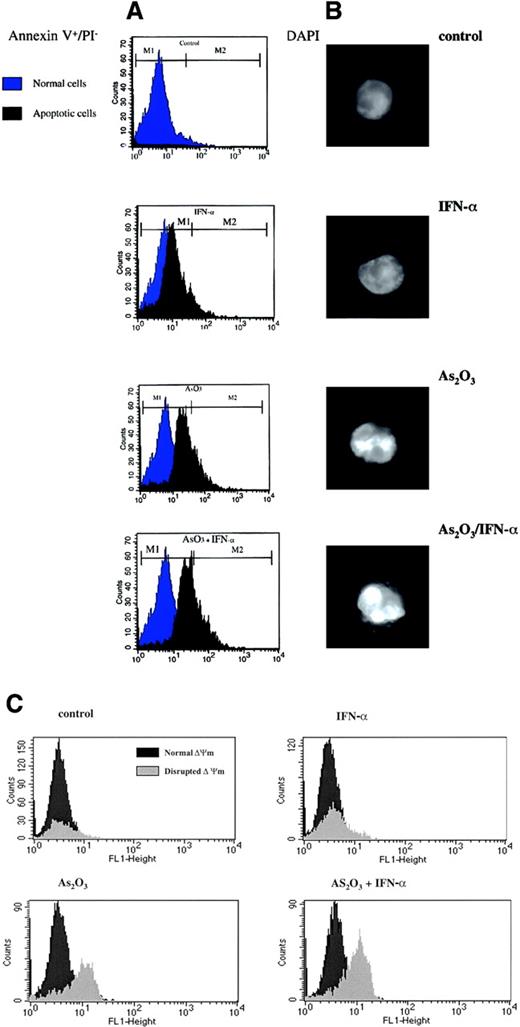 Fig. 1. As2O3or IFN-α + As2O3 induced apoptosis in HTLV-1 infected cell lines. / (A) FACS, (B) DAPI staining, or (C) ΔΨm collapse analyses of HTLV-1–infected cells after various treatments. (A) MT-2 cells were treated with buffer control, IFN-α, As2O3, or IFN-α + As2O3 for 60 hours. Cells were then harvested and washed in PBS without Ca++/Mg2+. They were stained using the Vybrant Apoptosis kit. Annexin V conjugated to fluorescein allowed the identification of apoptotic cells, whereas PI allowed the identification of dead cells. Apoptotic cells were annexin V+ and PI−. (B) DAPI staining of MT-2 cells after the same treatments. Magnification × 40. (C) ΔΨm Collapse was measured with the Apoalert Mitochondrial Membrane Sensor kit. Results are representative of at least 2 experiments performed with different HTLV-1–transformed cells.