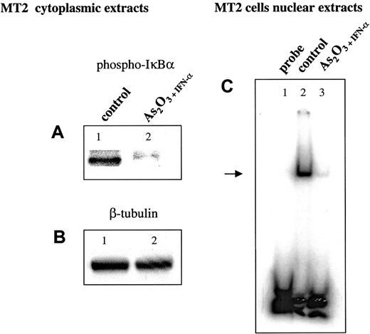 Fig. 3. Inhibition of NF-κB activation by As2O3 in HTLV-1–infected cells. / (A) Sixty micrograms cytoplasmic protein was resolved on 10% to 20% Tris-glycine, transferred to PVDF membranes, and probed with an antibody specific for the phosphorylated form of IκBα. Results are representative of 2 independent experiments. (B) Comparable protein loading was verified using an antibody specific for the housekeeping gene product β-tubulin. Results are representative of 2 independent experiments. (C) Electrophoretic mobility shift assay using a previously published NF-κB–specific probe43 mixed with no extract (lane 1), mixed with 5 μg nuclear extract obtained from MT-2 treated with control buffer (lane 2), or treated with As2O3 + IFN-α and run on a 6% DNA retardation gel (lane 3). Specificity of the NF-κB binding was checked by competition with a 50-fold excess of cold probe (data not shown).