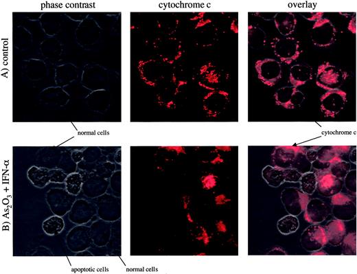Fig. 7. Caspase-3–dependent cleavage of Bcl-2 promotes release of cytochrome. / c from the mitochondria. HUT-102 cells were treated with (A) control buffer, IFN-α (data not shown), As2O3 (data not shown), or (B) with As2O3 + IFN-α for 60 hours. They were stained with a specific cytochrome c antibody and were analyzed by confocal microscopy. Magnification × 63.