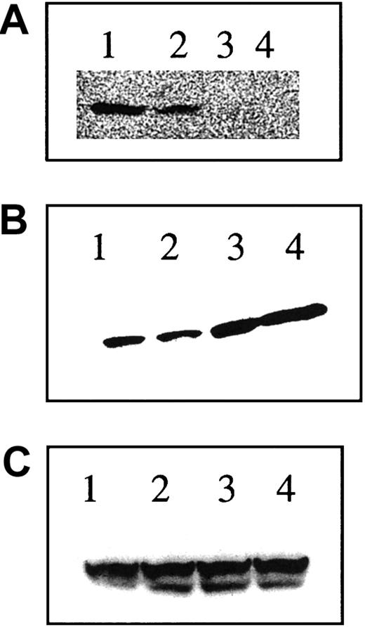 Fig. 8. Tax expression is down-regulated but p24 is up-regulated after arsenic trioxide treatment. / MT-2 cells were treated with control buffer, IFN-α, As2O3, or As2O3 + IFN-α for 48 hours. Sixty micrograms total protein was then resolved on 16% Tris-glycine gels transferred to PVDF membranes and probed with specific antibodies for (A) Tax or (B) Gag p24. Comparable protein loading was verified using an antibody specific for the β-tubulin protein (C).