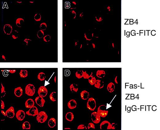 Fig. 2. Fas clusters in KG1a and U937 cell lines. / KG1a cells (A, C) and U937 (B, D) were treated (C, D) or not (A, B) with 0.5 μg/mL Fas-L for 4 hours. After washing, cells were incubated for 2 hours with ZB4 monoclonal antibody and then with FITC-conjugated goat–anti-mouse monoclonal antibody. Confocal analysis was performed as described in “Materials and methods.” Fas aggregation was shown as dense patchy staining (see arrows).