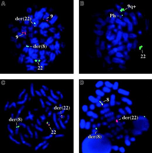 Fig. 1. FISH analysis. / (A) Patient 1 with the BCR-ABL D-FISH probes (ABL, red; BCR, green). (B) A Ph positive CML patient with bK143F12. (C) Patient 1 cohybridized with bK143F12 (green) and bK514C6 (red). (D) Patient 1 cohybridized with PAC 162N14 (green) and PAC 224C10 (red), clones that flank FGFR1.