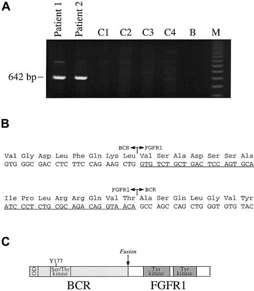 Fig. 2. RT-PCR analysis. / (A) RT-PCR analysis with primers E1+ and FGFR9− show the presence of a specific band in patients 1 and 2, but not in 4 control patients with CML (C1-C4); B indicates blank; M, 123-bp ladder. (B) In-frame fusions of BCR-FGFR1 and FGFR1-BCR. FGFR1 sequences are underlined. (C) Structure of BCR-FGFR1 in which BCR amino acid 584 is fused to FGFR1 amino acid 429. The chimeric protein is predicted to contain the BCR oligomerization domain (OD), the BCR Ser/Thr kinase domains, and Y177 Grb2-binding site joined to part of the FGFR1 juxtamembrane domain and the entire FGFR1 tyrosine kinase and C-terminal domains.