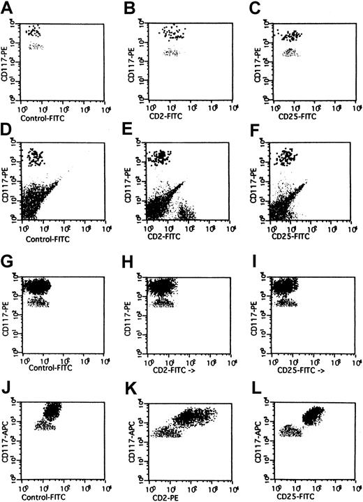 Fig. 1. Expression of CD2 on BM MCs in mastocytosis. / Multicolor flow cytometry analysis of expression of CD2 on human BM MCs. BM MCs were obtained from a healthy donor (A-C), one with reactive MC hyperplasia (D-F), one with MDS/RA (G-I), and one with SM (J-L). Expression of CD2 and CD25 on KITbright MCs was analyzed by multicolor staining. Isotype-matched control mAbs (A,D,G,J), the CD2 mAb S5.2 (B,E,H,K), and the CD25 mAb 2A3 (C,F,I,L) were applied. In the patient with SM, BM MCs were found to react with mAbs against CD2 (K) and CD25 (L). By contrast, BM MCs in RA as well as in the control cases were not recognized by CD2 mAb or CD25 mAb.
