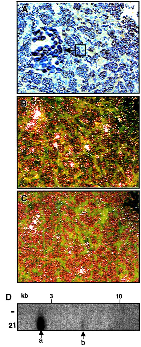 Fig. 8. Expression of. / Dll4 in lymphoma cells. Immunohistochemistry staining liver section from a Dll4-overexpressing animal (no. 21) with anti-CD3 antibody at 10.5 weeks after BMT (panel A). Results from in situ hybridization with antisense neo(panel B) and Dll4 (panel C) are shown in dark field view. Proviral junction analysis (panel D) of DNA from spleens of a normal mouse (−) and mouse no. 21 digested withSpeI shows that the animal contained one major (a) and one minor clone (b).