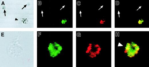 Fig. 7. Immunofluorescence analysis of DMT1 and Tf in RBCs. / Cells were incubated with Alexa-conjugated Tf (Alexa-Tf) before fixation and immunostaining with anti–DMT1-NT antibody and a rhodamine-conjugated secondary antibody. The slides were then examined by confocal microscopy (approximate depth of the optical sections = 1 μm), and the Alexa-TF (green; B,F) and rhodamine (red; C,G) images were overlaid (yellow identifies overlapping staining; D,H). In erythroid cell precursors (arrowhead in A and cell in E), the DMT1 staining (C,G) showed extensive overlapping staining with the distribution of Alexa-Tf (B+C = D and F+G = H; arrowhead). On the other hand, erythrocytes (arrows in panel A) were negative for both Alexa-Tf (arrows in panel B) and DMT1 (arrows in panel C) staining. Original magnification for A-D, × 400; E-H, × 1000.