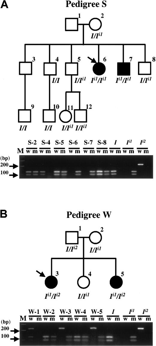 Fig. 3. Segregation of wild-type. / I, Ii1, andIi2 alleles in 2 adult i pedigrees. Pedigree drawings (upper) and PCR-SSP-RFLP analysis of the family members (lower) of pedigree S (A) and pedigree W (B). Pedigree drawing: To avoid confusing the blood group I phenotype and the I gene, the standard symbols for generations I, II, and III, are not used. Open and solid symbols for male (square) and female (circle) denote an person with common I and adult i phenotypes, respectively. I locus genotypes under each symbol are inferred from the results of PCR-SSP-RFLP analysis for each person. The adult i propositus in each pedigree is indicated by an arrow. Samples from S-1 and S-3 were unavailable in the current study to determine their I genotype; however, these persons were previously demonstrated to have I phenotype.27 PCR-SSP-RFLP analysis: w and m represent the PCR amplifications using the wild-type primer set and mutant primer set, respectively, for distinguishing theI and Ii1 alleles (described in “Materials and methods” and “Results”). The 218-bp PCR products were then digested with BstUI restriction endonuclease for distinguishing the I andIi2 alleles. Plasmid clones bearingI, Ii1, andIi2 cDNA segments served as control templates. The results for the third generation of pedigree S, S-9 to S-12, are not shown. Lane M shows the molecular mass standards of the 100-bp ladder.