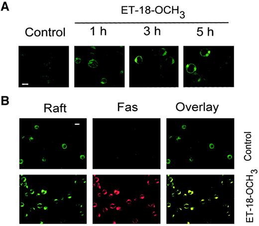 Fig. 1. Clustering of membrane rafts and Fas in ET-18-OCH3–treated Jurkat cells. / (A) Time course of the effect of ET-18-OCH3 on aggregation of membrane rafts. T-leukemic Jurkat cells, grown in 10% FCS-containing medium, were either untreated (Control) or treated with 5 μg/mL ET-18-OCH3 for the times indicated. Cells were then stained with FITC-CTx and analyzed by confocal microscopy. Bar indicates 7 μm. (B) Colocalization of membrane rafts (Raft) and Fas in ET-18-OCH3–treated Jurkat cells. Cells were either untreated (Control) or treated with 5 μg/mL ET-18-OCH3for 3 hours, and processed for confocal microscopy using FITC-CTx (green fluorescence for lipid rafts) and anti-Fas mAb, followed by CY3-conjugated antimouse antibody (red fluorescence for Fas). Areas of colocalization between membrane rafts and Fas in the overlay panels are yellow. Bar indicates 10 μm.