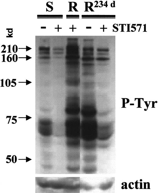 Fig. 3. Restoration of sensitivity to STI571. / Phosphotyrosine (p-Tyr) immunoblot of LAMA84-s (S), LAMA84-r (R), and resistant cells grown in the absence of STI571 for 234 days (R234d) exposed to 1 μ μM STI571 for 2 hours, as compared with nonexposed aliquots. Densitometric analysis of the p210 Bcr-Abl band corrected for the actin control showed a 2.1-fold decrease in phosphorylation of LAMA84-s and a 3.0-fold for the LAMA84-R234d line upon treatment with STI571. As previously shown,4 LAMA84-r cells kept continuously in the presence of STI571 have an elevated phosphotyrosine content.