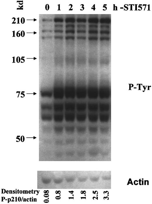 Fig. 5. Increased phosphotyrosine content on withdrawal of STI571 from LAMA84-r cells. / Total cellular protein was harvested from cells grown continuously in the presence of 1 μM STI571 (time zero) and then hourly after thorough washing and reculture in media without STI571. The Western blot membrane was probed with an antiphosphotyrosine antibody (upper panel) and reprobed with an antiactin antisera (lower panel). The densitometric ratio of the phospho-Bcr-Abl (p-p210)/actin bands is shown for each time point and demonstrates a 41-fold increase in Bcr-Abl autophosphorylation after 5 hours of STI571 withdrawal.