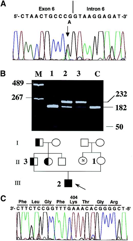 Fig. 1. Molecular analysis. / (A) Direct sequencing of the amplified CPO genomic DNA fragment from the patient. The sequence around the mutation site is shown. A single base substitution, G-to-A, at the last nucleotide of the splicing donor site of exon 6 is shown as double peaks and is indicated by an arrow. (B) Pedigree of the family. Circles denote females; squares denote males; half-shaded symbols denote HCP heterozygous. N indicates not tested. An arrow denotes the proband MspI restriction site analysis of the amplified genomic DNA fragment. PCR-amplified fragments (232 bp) of the mother (lane 1) and a healthy control not related to the family (C) were completely digested into 182-bp and 50-bp fragments, whereas those of the patient (lane 2) and the father (lane 3) were only partially digested. Lane M, DNA molecular weight standard pHY size marker (Toyobo, Tokyo, Japan). Numbers on the left and right indicate the sizes of DNA size markers and fragments, respectively, observed in this analysis. (C) Sequence around the region encoding the amino acid Lys 404 showed a normal pattern.