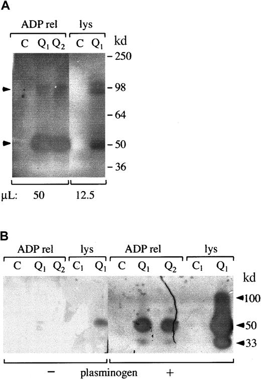 Fig. 2. Fibrin gel zymograms of proteases in QPD platelets. / Samples of QPD (Q1 and Q2 indicate patients from families 1 and 2, respectively) and control (C) platelet lysates (lys; A, 12.5 μL; B, 2 μL) and ADP releasates (ADP rel; A, 50 μL; B, 2 μL) were analyzed on fibrin substrate gels after 9% (A) or 5% to 15% (B) nonreduced SDS-PAGE. (A) Analyses using gels without added plasminogen indicated QPD platelets contained 50-kd (major band) and 100-kd (minor component) secretable, fibrinolytic proteases (arrows) that were not evident in the same amount of control samples. (B) Comparative analyses, using substrate gels with (+) or without (−) added plasminogen, indicated the 100- and 50-kd QPD platelet proteases had properties of plasminogen activators. A 33-kd plasminogen activator was also detected in QPD (but not in control) platelets and releasates (Mr based on 5%-15% nonreduced SDS-PAGE).